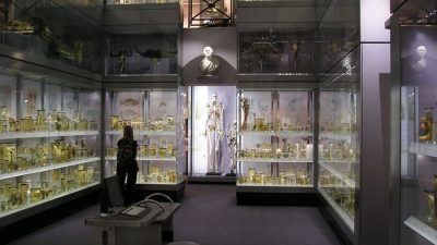 Фото. Скелет Чарльза Бирна в Королевском колледже хирургов, Лондон.  (StoneColdCrazy/commons.wikimedia.org/CC BY-SA 3.0)