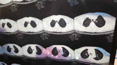 Врач смотрит на компьютерную томографию пациента в Хайдяне, Пекин, Китай, 2 января 2023 года. (CFOTO/Future Publishing via Getty Images)
