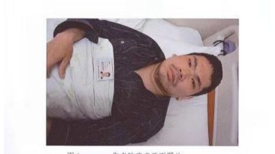 Лу Сяочжун в больнице Дитан 13 апреля 2016 года после ранения бандитом из Шанхайского института биологических продуктов, когда пытался подать жалобу в офис петиций Sinopharm в Пекине по поводу некачественного фактора свертывания крови VIII, который вызвал различные осложнения и генерализованный некроз суставов. (Courtesy of Lu Xiaozhong)
