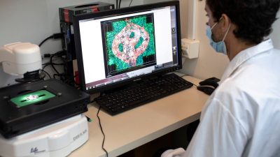 Израильский исследователь Эйлам Йейни рассматривает под микроскопом изображение трубки кровеносного сосуда, окружённой раковыми тканями, в рамках исследования рака мозга, в котором используются клетки пациентов для создания 3D-печатных моделей опухолей, в Тель-Авивском университете, Израиль, 17 августа 2021 года. (Nir Elias/Reuters)

