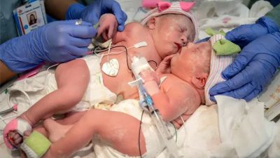 (Courtesy of Texas Children’s Hospital)