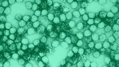 Врус жёлтой лихорадки под электронным микроскопом. (Erskin L. Palmer/CDC)