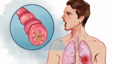 Лекарства от астмы не существует, но симптомы можно купировать с помощью правильного лечения. (Illustrations by The Epoch Times, Shutterstock)