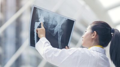 Для здоровья костей лучшим решением является диета, богатая природным кальцием. (Image: NaruFoto via Shutterstock)