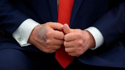 На тыльной стороне правой руки президента США Дональда Трампа виден синяк во время встречи с президентом Южной Кореи Ли Чжэ Мёном в Овальном кабинете Белого дома 25 августа 2025 года в Вашингтоне, округ Колумбия. (Chip Somodevilla/Getty Images)